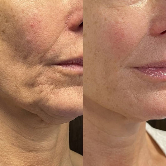 Anti-Aging Serum Stick met Bijengif-Peptiden voor Rimpelvermindering