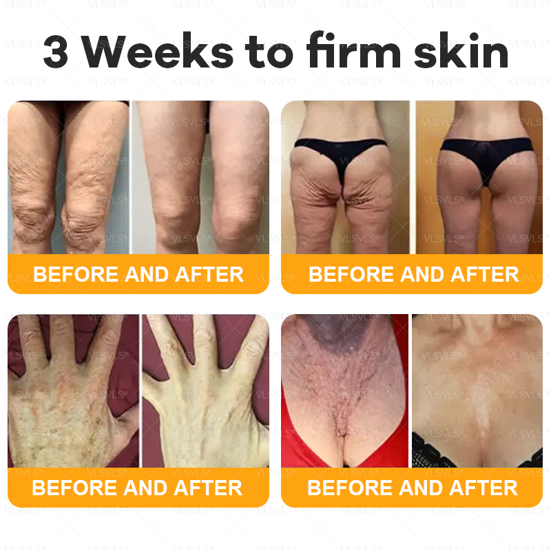 Verstevigende Anti-Aging Crème met Bijengifpeptiden en Hyaluronzuur