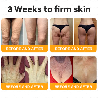 Verstevigende Anti-Aging Crème met Bijengifpeptiden en Hyaluronzuur