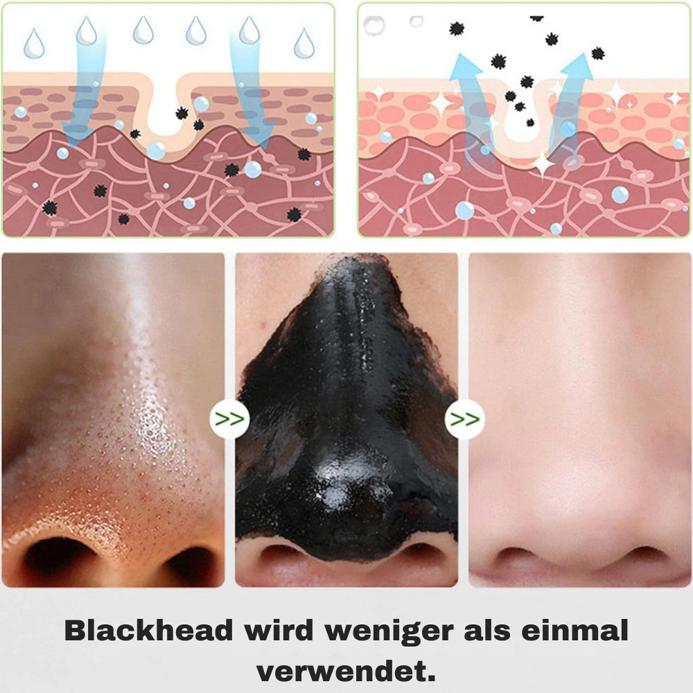 Actieve Kool Peel-Off Masker voor Diepe Poriënreiniging