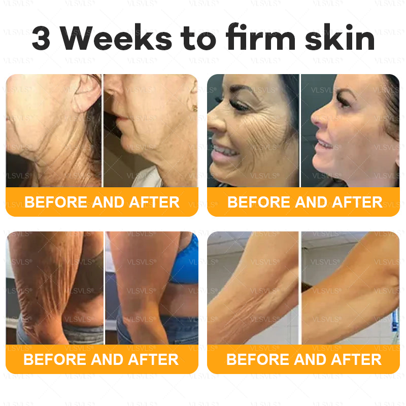 Verstevigende Anti-Aging Crème met Bijengifpeptiden en Hyaluronzuur