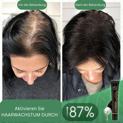 Biologische Haarserum-Roller voor Haargroei en Volume