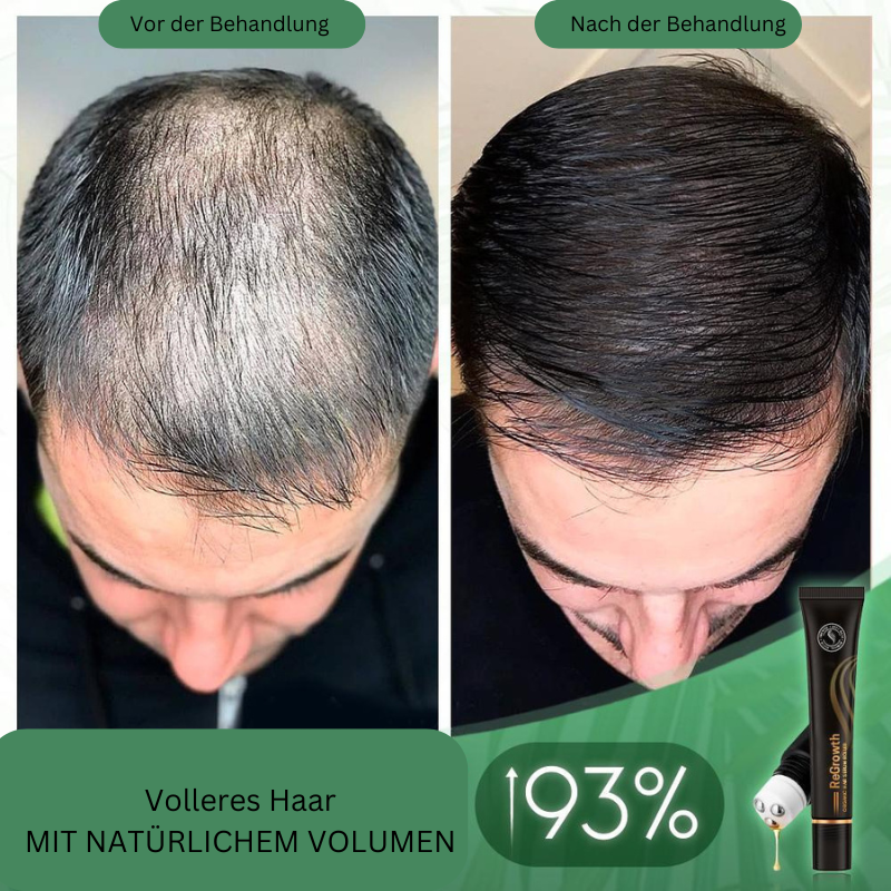 Biologische Haarserum-Roller voor Haargroei en Volume