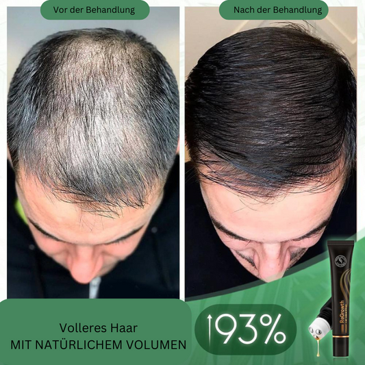 Biologische Haarserum-Roller voor Haargroei en Volume