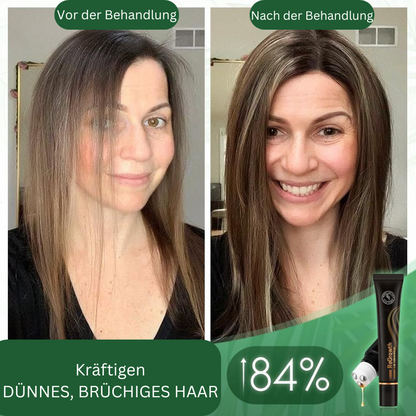Biologische Haarserum-Roller voor Haargroei en Volume