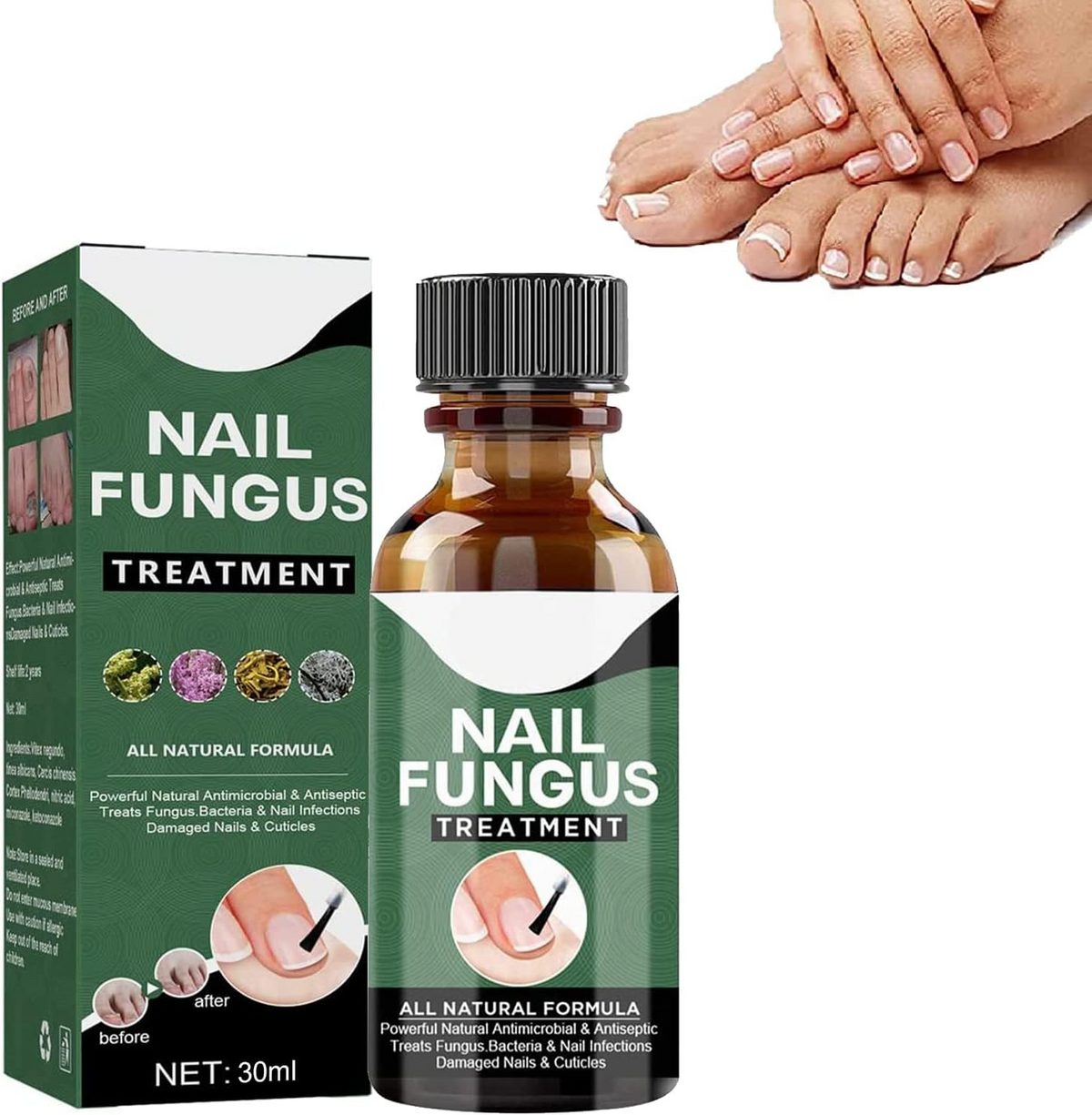 Nagelschimmel Behandeling Serum voor Gezondere en Sterkere Nagels