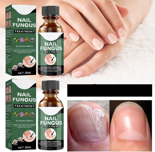 Nagelschimmel Behandeling Serum voor Gezondere en Sterkere Nagels