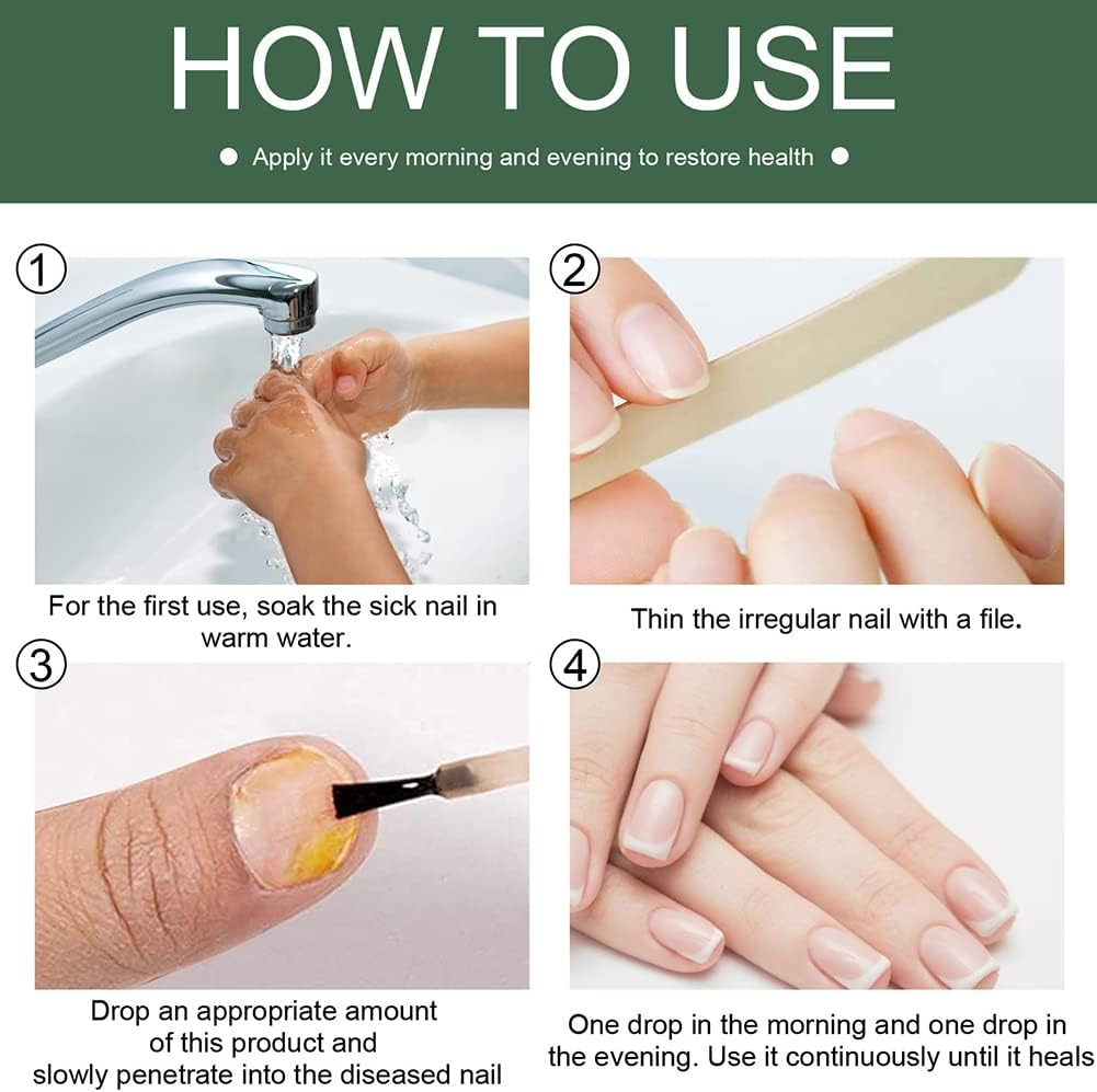 Nagelschimmel Behandeling Serum voor Gezondere en Sterkere Nagels