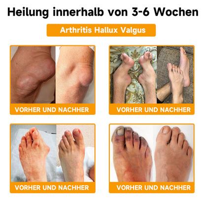 Bijengiftcrème met Hyaluronzuur & Collageen voor Gezicht en Hals