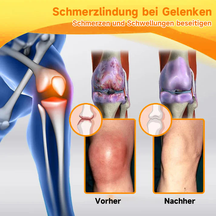 Bijengifcrème met Hyaluronzuur en Collageen voor Gezicht en Lichaam